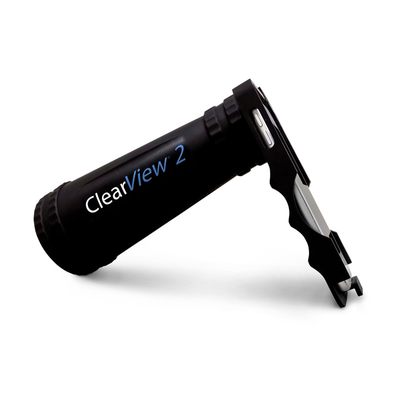 ClearView® 2 Funduskamera