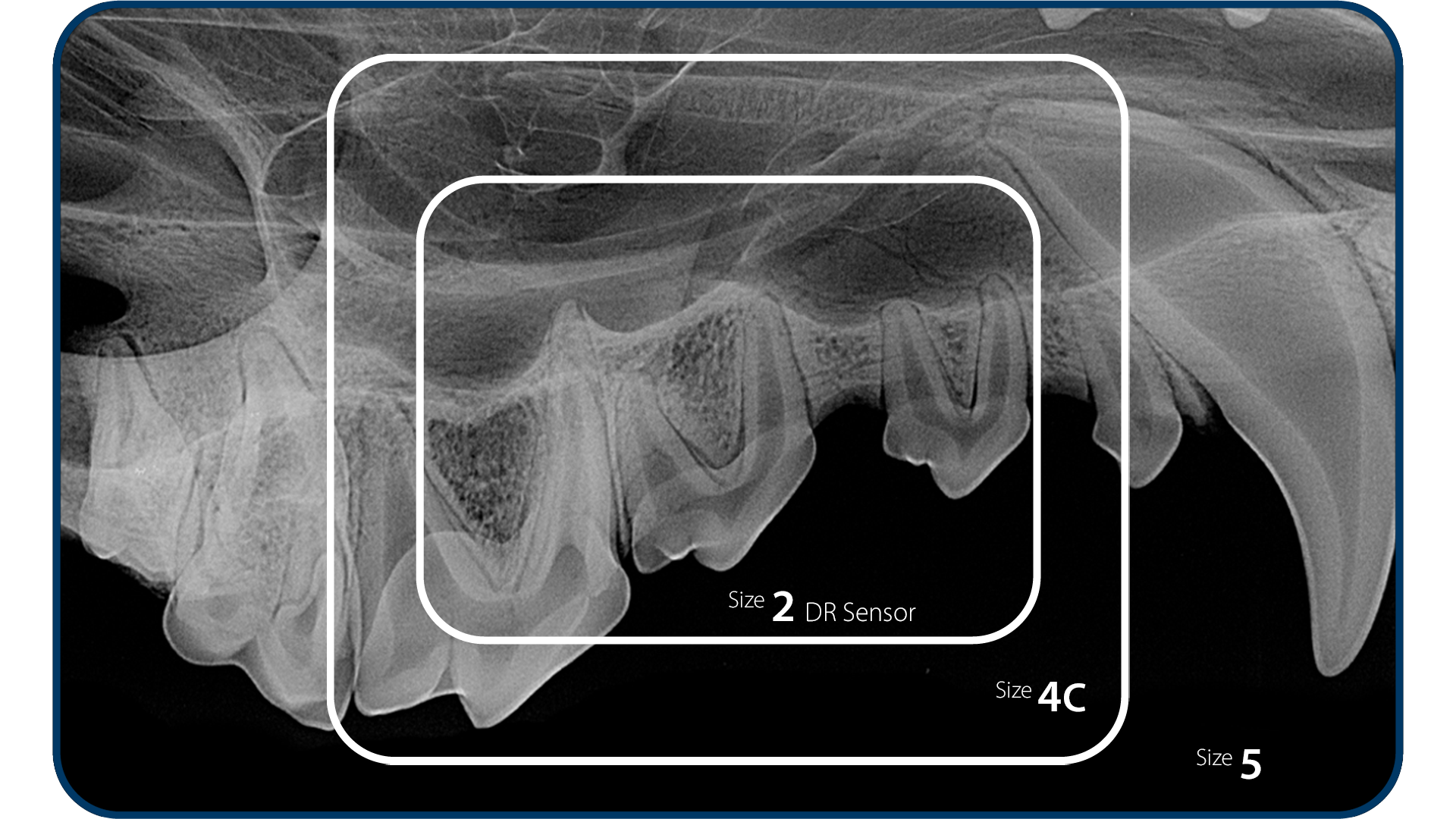 Dental røntgenfremkalder IM3 CR8 VET